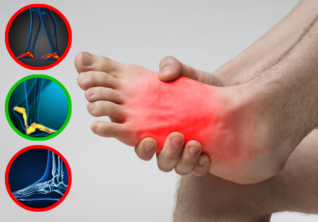 Foot Misalignments: 5 Tips for Foot Health