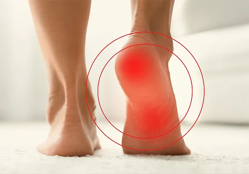 The Hidden Secret Of Ancient Pain Management For The Modern Plantar Fasciitis Epidemic