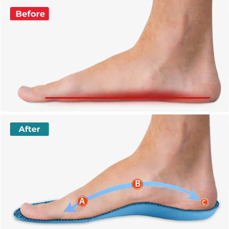Comfysole - Walk Without Pain - upsale - cc - soothsocks - native