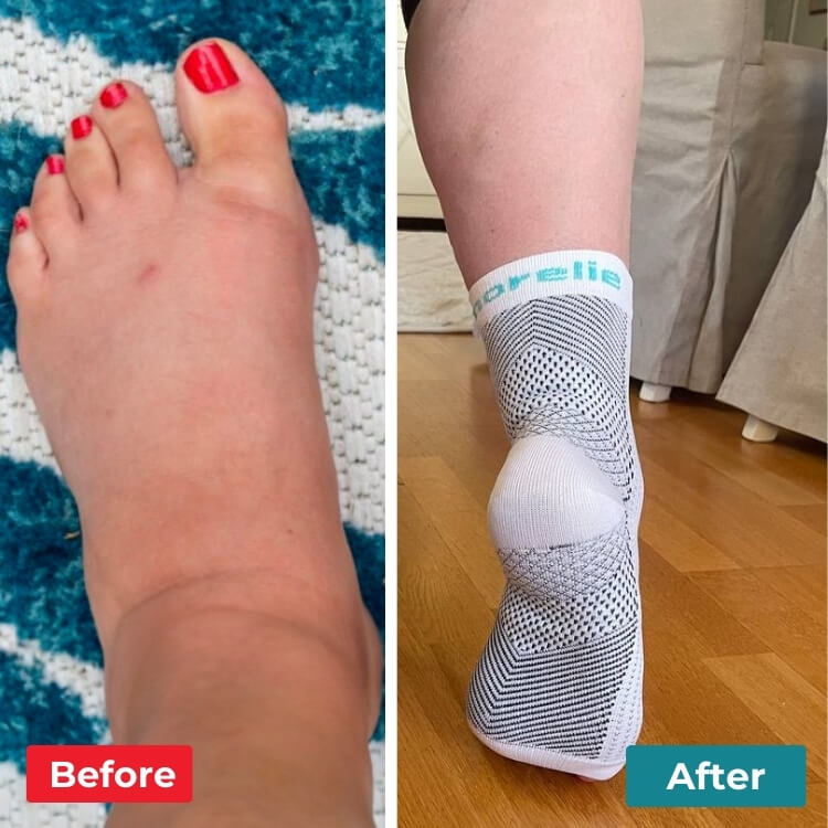 StepEase Compression Socks - Upsell - Soothesocks