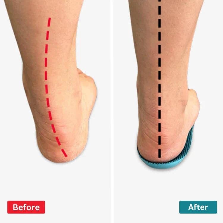 Comfysole - Walk Without Pain - upsale - cc - soothsocks - native
