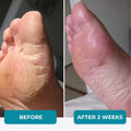 Flawless Feet Routine